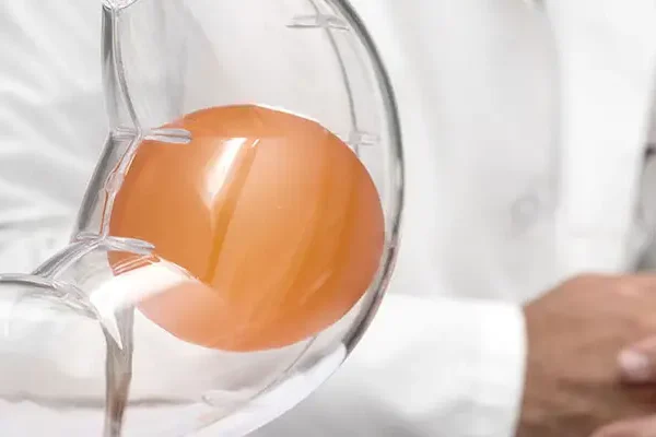 Gastric Balloon Candidates