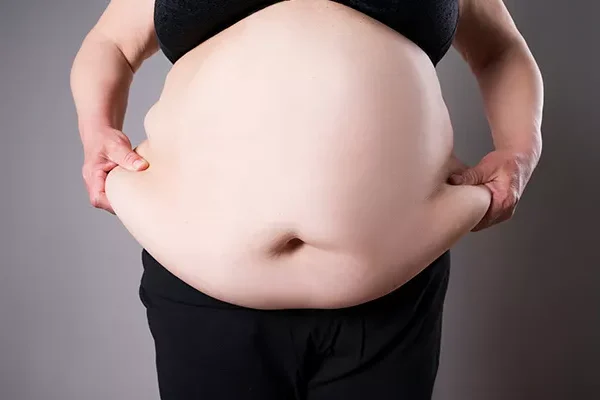 Obezite “sosyal bulaşıcı” hastalık