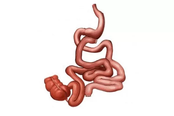 Transit Bipartition Surgery