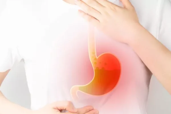 Reflü Nedir? Reflü Nasıl Tedavi Edilir?